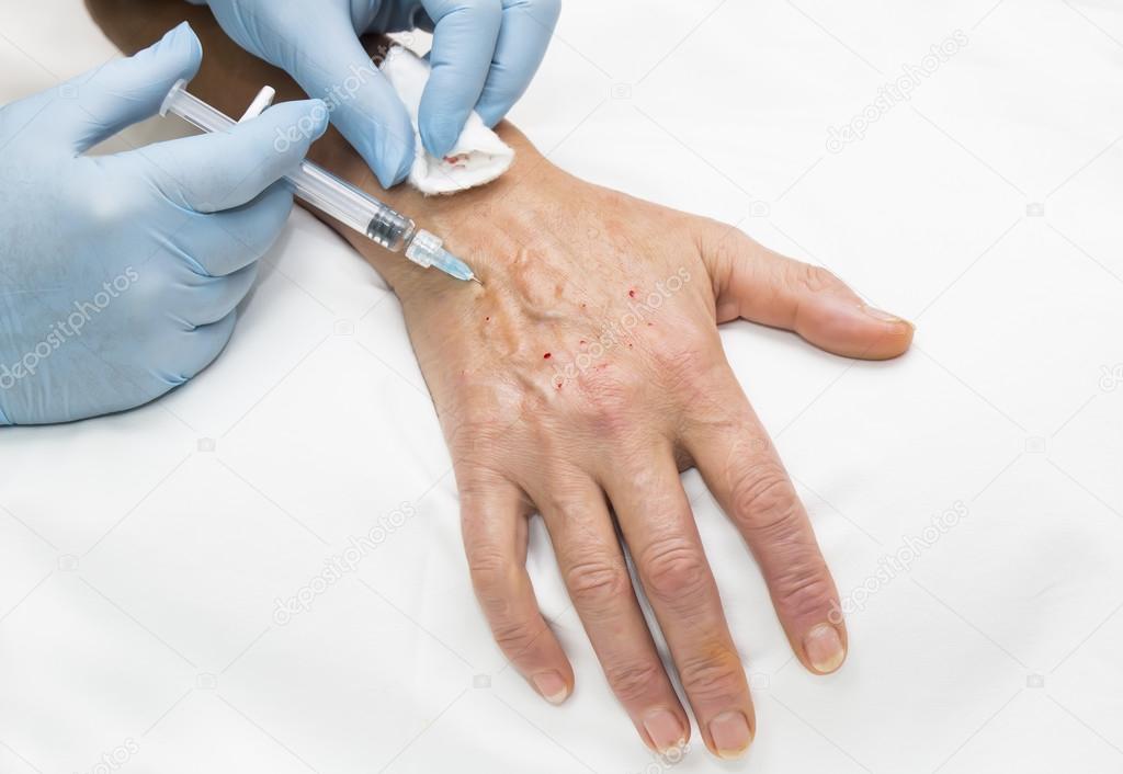 woman's hand passes Biorevitalisation