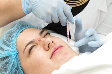 işlem selülit kadındır 