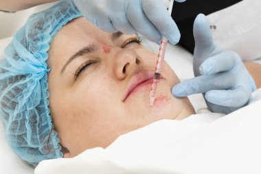 işlem selülit kadındır 