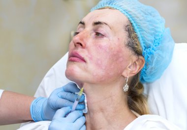 Enjeksiyon ile kozmetik tedavi
