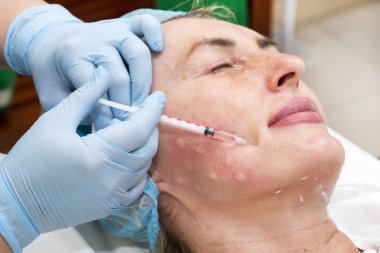 Enjeksiyon ile kozmetik tedavi