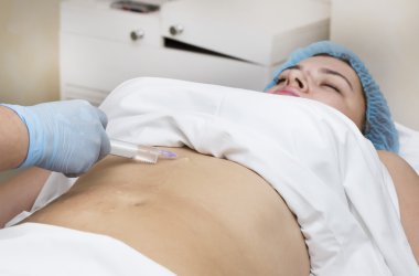 işlem selülit kadındır