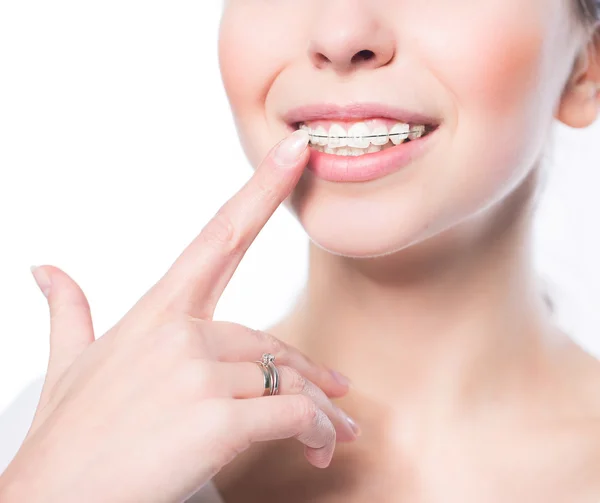 Mulher com aparelho dentário — Fotografia de Stock