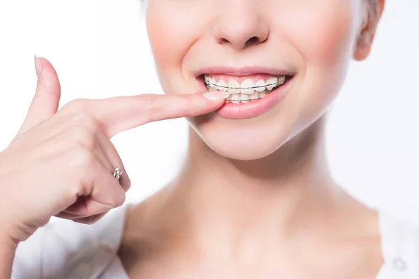 Mujer con abrazaderas de dientes — Foto de Stock