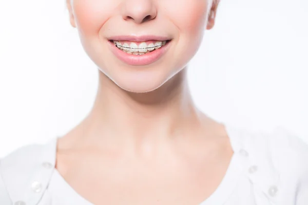 Žena s zuby rovnátka — Stock fotografie
