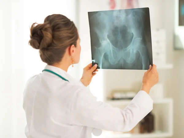 Doctor woman looking on fluorography. rear view — Stock Photo, Image