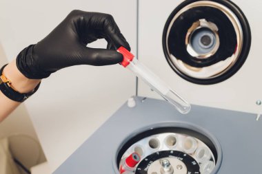 Trombosit zengini plazma hazırlığı. Elleri kanlı tüp. Santrifüj. Arkaplan.