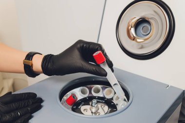 Trombosit zengini plazma hazırlığı. Elleri kanlı tüp. Santrifüj. Arkaplan.