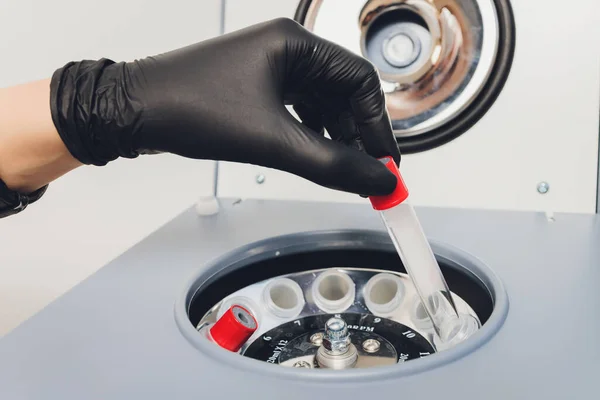 Platelet-Rich plasma preparation. Tube with blood in hands. Centrifuge. Background.