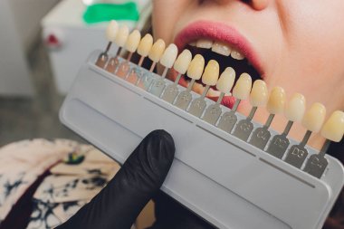 Dişçi koltuğundaki genç kadınların portresini kapat, kontrol et ve dişlerin rengini seç. Diş hekimi muayenehanesinde tedavi yöntemini uygular..