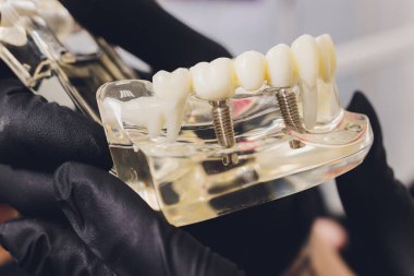 Ortodontist eğitim için çenesini elinde tutuyor. Kılcal damarları, kökleri, iğneleri olan paket.