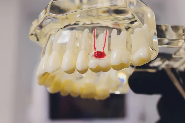 Orthodontist houdt kaak in zijn handen voor training. Pakket met haarvaten, wortels, spelden. — Stockfoto