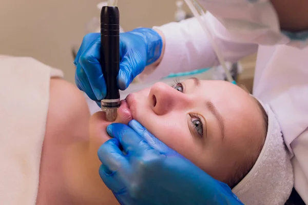 Woman cleaning nose skin pores using vacuum blackhead remover, cosmetic procedure.