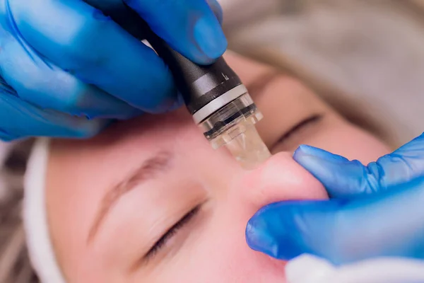 Mujer limpiando poros de la piel de la nariz usando removedor de cabeza negra de vacío, procedimiento cosmético. — Foto de Stock