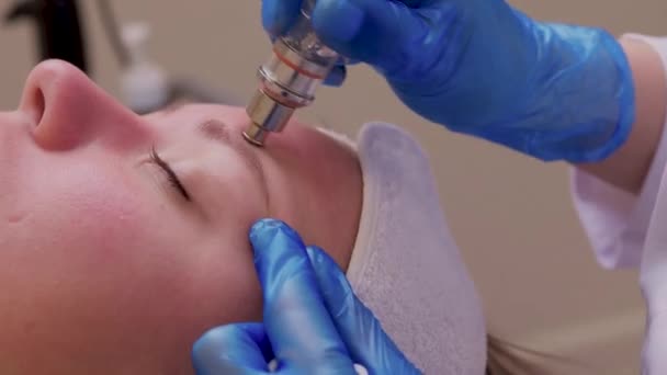 Mujer limpiando poros de la piel de la nariz usando removedor de cabeza negra de vacío, procedimiento cosmético. — Vídeos de Stock