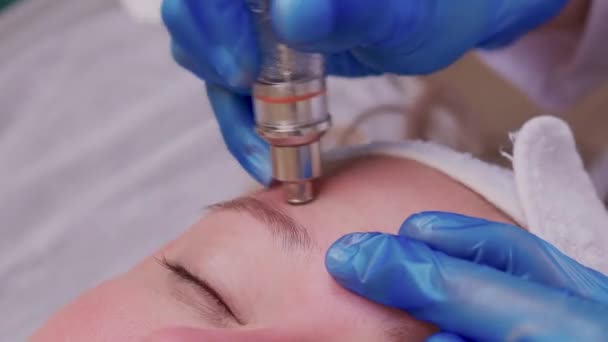 Kvinna rengöring näsa porer hud med hjälp av vakuum blackhead remover, kosmetisk procedur. — Stockvideo