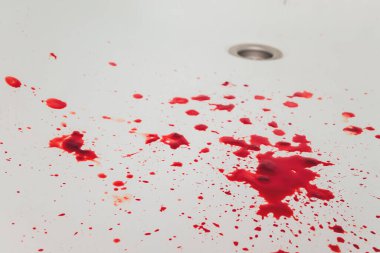 Banyo lavabosundan kan boşalıyor. Su havzasında kanlı lekeler var..