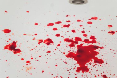 Banyo lavabosundan kan boşalıyor. Su havzasında kanlı lekeler var..