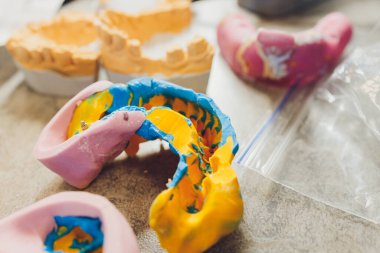 Diş laboratuarında diş protezi yapma süreci.