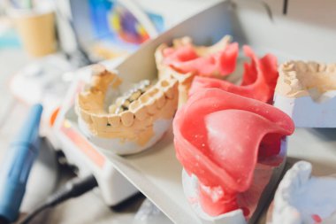 Diş laboratuarında diş protezi yapma süreci.