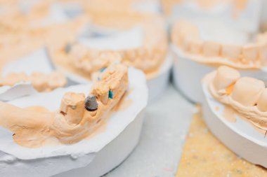 Diş laboratuarında diş protezi yapma süreci.