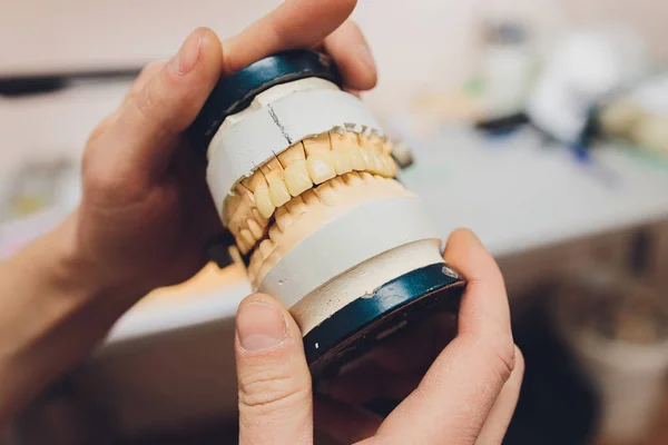 Der Prozess der Herstellung einer Zahnprothese in einem Dentallabor. — Stockfoto