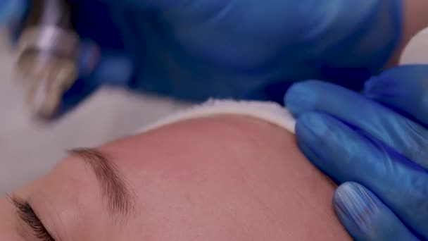 Mulher limpeza de poros de pele do nariz usando removedor blackhead vácuo, procedimento cosmético. — Vídeo de Stock