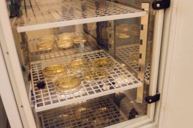 Peri tabağında büyüyen E. koli. Marul örneğinden toplanmış..