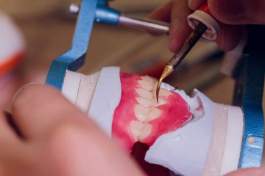 Diş laboratuarında diş protezi yapma süreci.