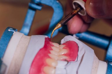 Diş laboratuarında diş protezi yapma süreci.