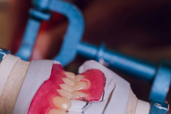 Der Prozess der Herstellung einer Zahnprothese in einem Dentallabor. — Stockfoto