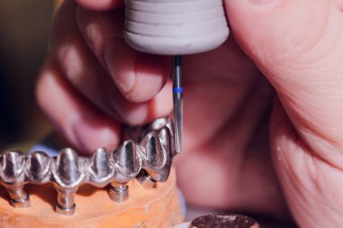 Diş laboratuarında diş protezi yapma süreci.