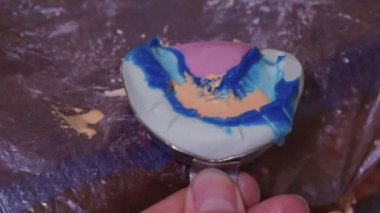 Diş laboratuarında diş protezi yapma süreci.