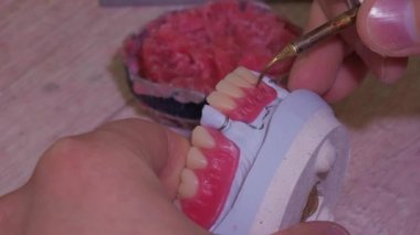 Diş laboratuarında diş protezi yapma süreci.