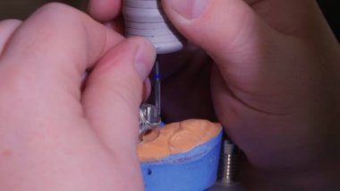 Diş laboratuarında diş protezi yapma süreci.