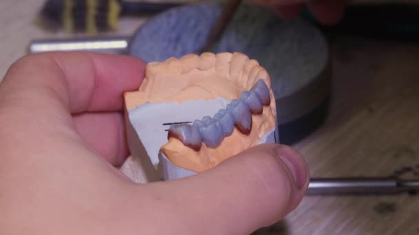 歯科研究室で歯列矯正を行う過程. — ストック動画