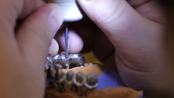 Processen att göra en tandprotes i ett dentallaboratorium. — Stockvideo