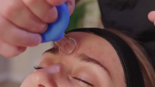 Masaje facial con tazas en el salón de spa. — Vídeos de Stock
