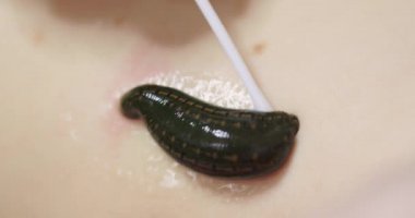 Geleneksel alternatif tıp - doktor genç bir kadın için hiroterapi uyguluyor.