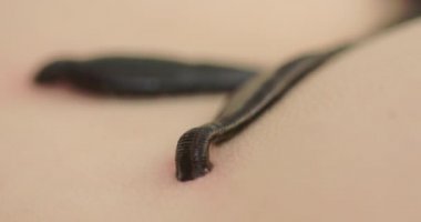 Geleneksel alternatif tıp - doktor genç bir kadın için hiroterapi uyguluyor.