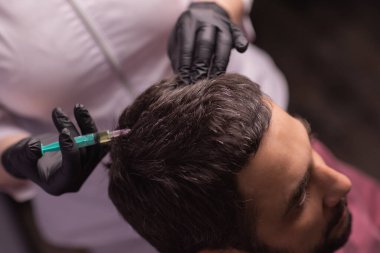 Saç için mezoterapi. Çekici bir adam kafasından iğne vuruluyor. Güzellik salonunda mezoterapi gören bir adam, şırıngalı koruyucu eldivenli bir terapist.,