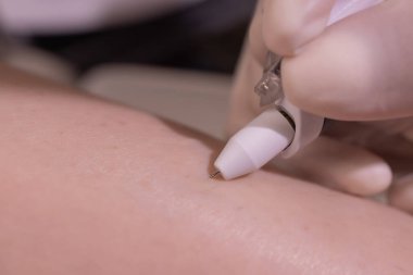 Profesyonel bir güzellik uzmanının eldivenli epilasyon sırasında mor çarşaf üzerindeki kadın bacakları. Spa, güzellik endüstrisi, klinikte tedavi, elektroliz.