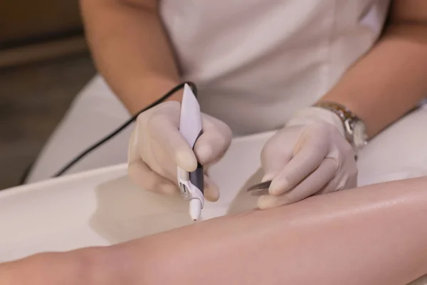 Gambe femminili su lenzuolo viola durante l'epilazione da un estetista professionista in guanti. Spa, industria della bellezza, trattamento in clinica, elettrolisi. — Foto Stock