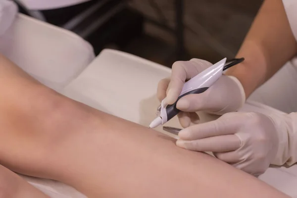 Weibliche Beine auf lila Laken während der Epilation durch eine professionelle Kosmetikerin mit Handschuhen. Wellness, Kosmetikindustrie, Behandlung in der Klinik, Elektrolyse. — Stockfoto