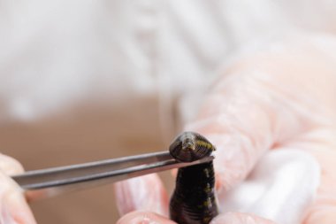 Geleneksel alternatif tıp - doktor genç bir kadın için hiroterapi uyguluyor.