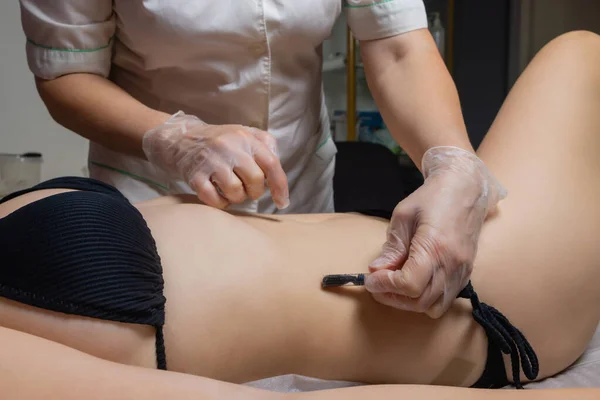 Medicina alternativa tradizionale - dottore che fa la procedura di hirudotherapy per donna giovane. — Foto Stock