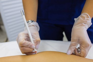 Güzellik Uzmanı Kalçadaki Kadına Epilasyon Lazeri Tedavisi Veriyor.