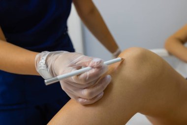 Güzellik Uzmanı Kalçadaki Kadına Epilasyon Lazeri Tedavisi Veriyor.