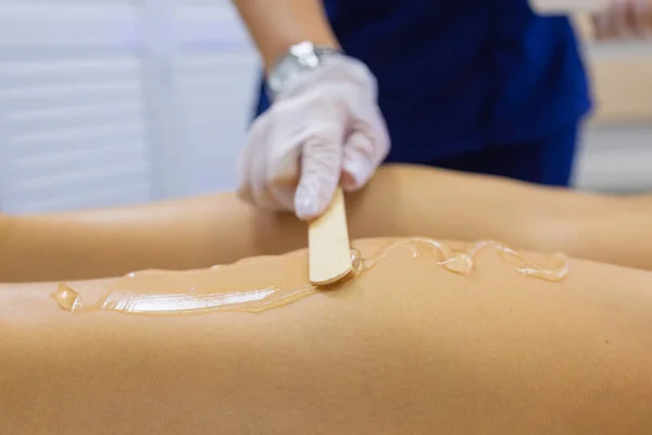 Estetista dando trattamento laser di epilazione alla donna sulla coscia. — Foto Stock
