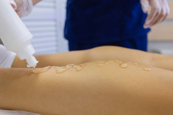 Beautist ger Epilation Laser behandling till kvinna på lår. — Stockfoto